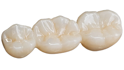 NuArt Dental | Trusted Dental Lab Solutions Since 1977